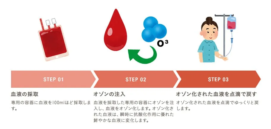 オゾン療法の流れ STEP01 血液の採取/STEP02 オゾンの注入/STEP03 オゾン化された血液を点滴で戻す